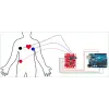 EKG moodul, kolme juhtmega AD8232
